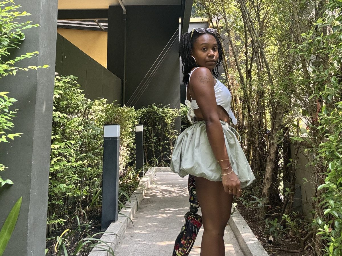 Show Them the&nbsp;Leg