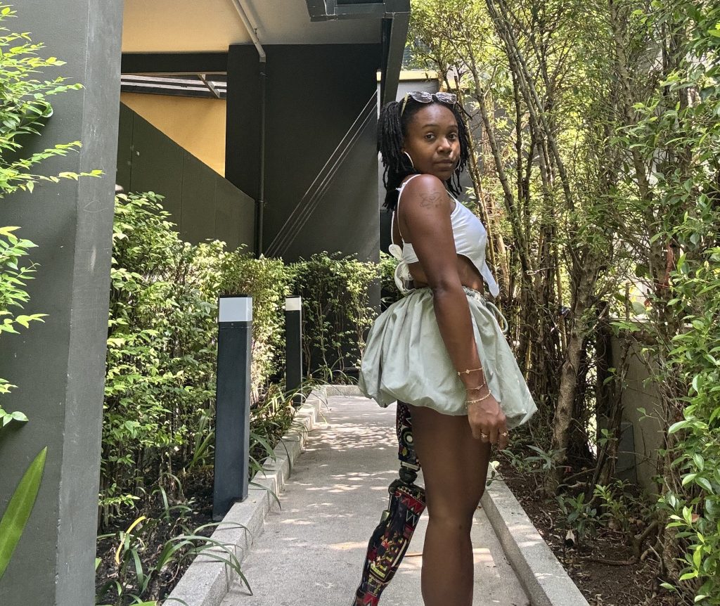 Show Them the&nbsp;Leg